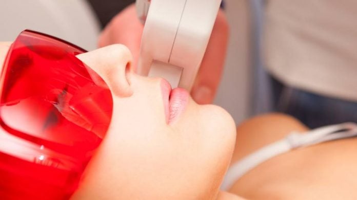 depilazione laser depilazione laser