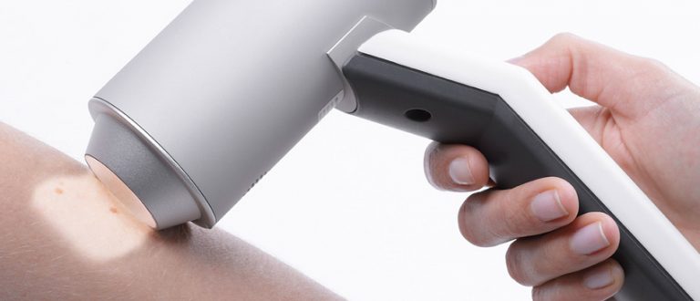 Dermatoscopia digitale