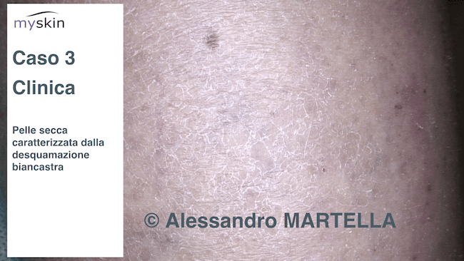 Prurito Cane Shampoo Anti Prurito Per Cani HAPPY SKIN - 200ml Con Olio Di Cedro E Lavanda Shampoo Idratante Cani Wolfsbacher