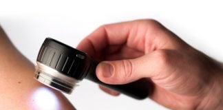 La prevenzione: teoria e pratica dermatoscopio_manuale