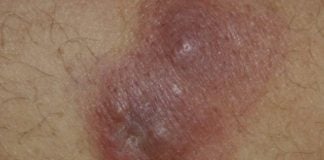 Il dermatologo e l’errore perfetto image_post_200901221212
