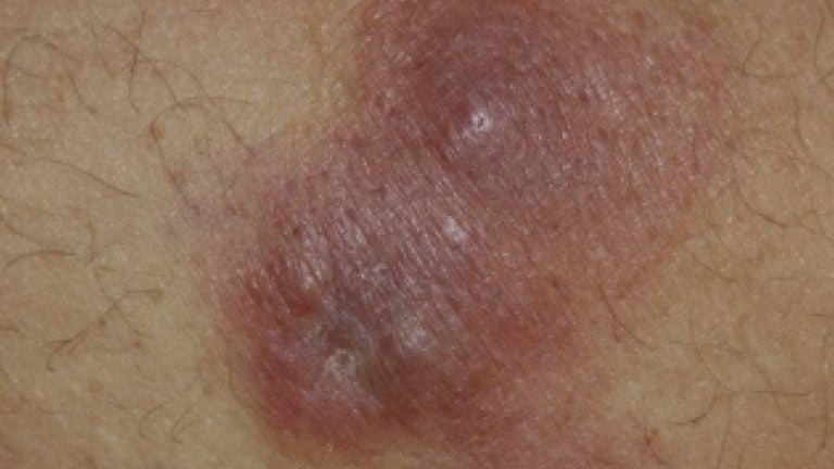 image_post_200901221212