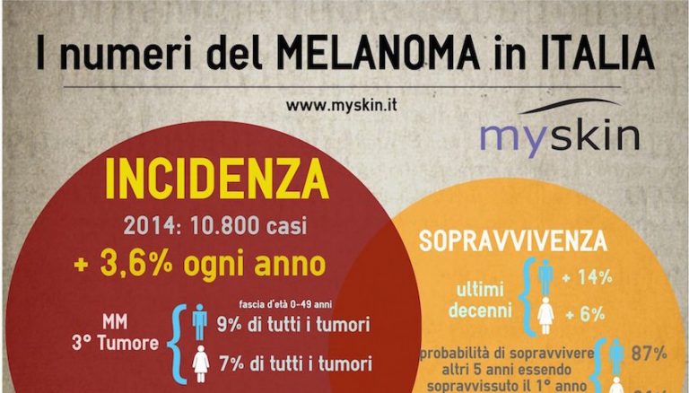 Il Melanoma: cos’è, come si manifesta, i segni e i sintomi