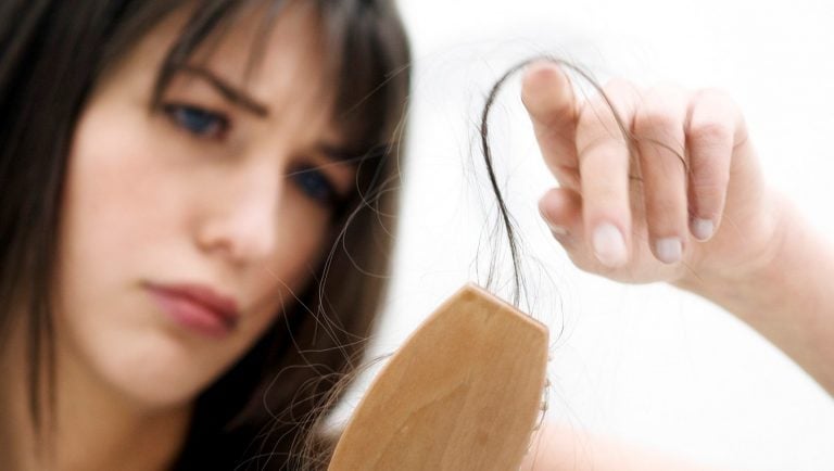 Telogen effluvium e diradamento dei capelli