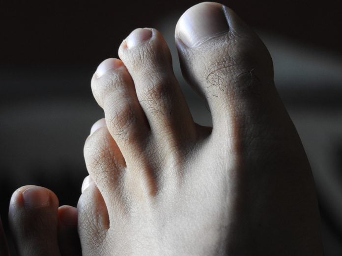 unghie-piedi unghie-piedi