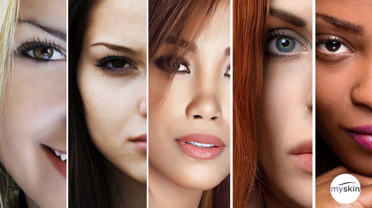 Qual è il tuo fototipo? Qual è il tuo fototipo?