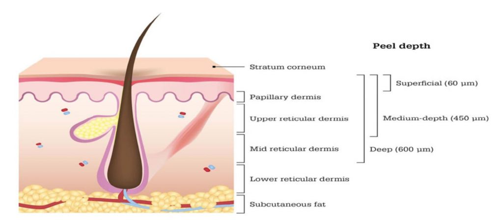 epidermide-derma