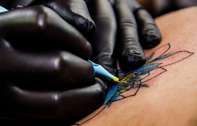 Rimozione tatuaggi con la laser terapia