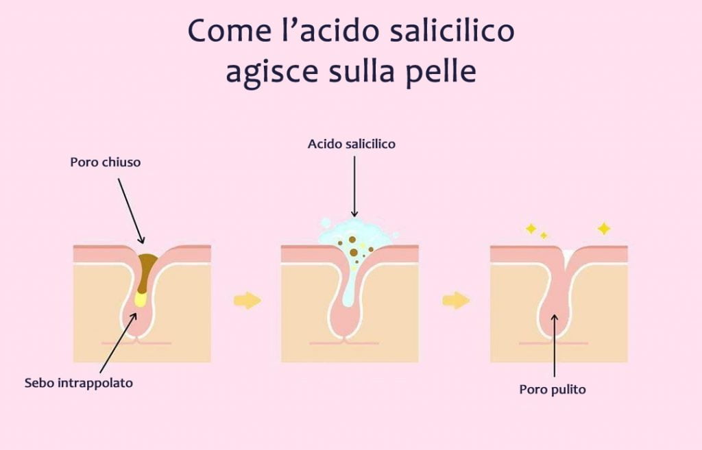 azione-acido-salicilico