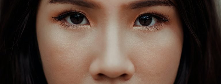 Pori del naso dilatati: cosa sono e cosa li causa?